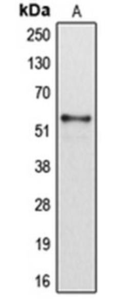 Western blot analysis of HepG2 (Lane 1) whole cell lysates using CYP2B6 antibody