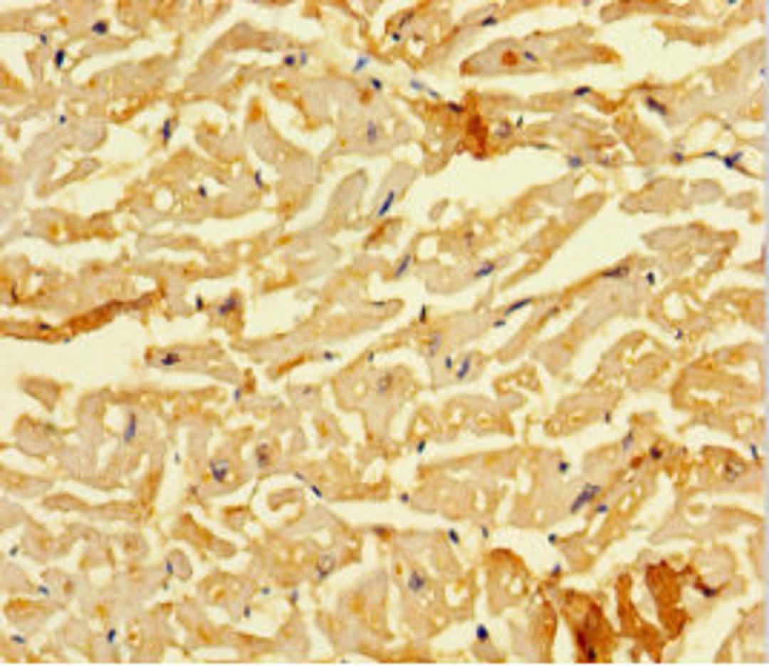Immunohistochemistry of paraffin-embedded human heart tissue using CSB-PA618998HA01HU at dilution of 1:100