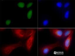 Immunocytochemistry/Immunofluorescence: ZNF521 Antibody [NBP1-91270] - Zfp521 antibody was tested in U2OS cells with FITC (green). Nuclei and alpha-tubulin were counterstained with DAPI (blue) and Dylight 550 (red).