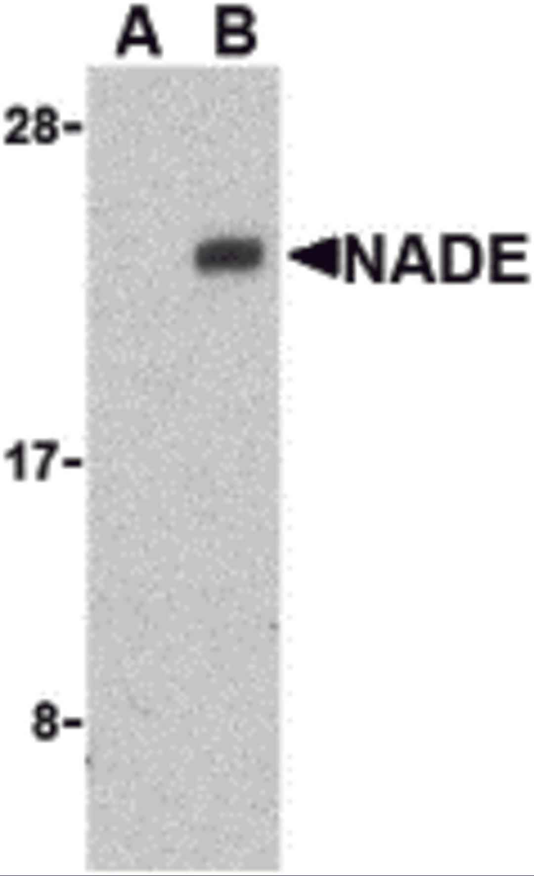 Western blot analysis of NADE in Human brain cell lysates with NADE antibody at 1 &#956;g/mL in the presence (A) or absence (B) of blocking peptide. 