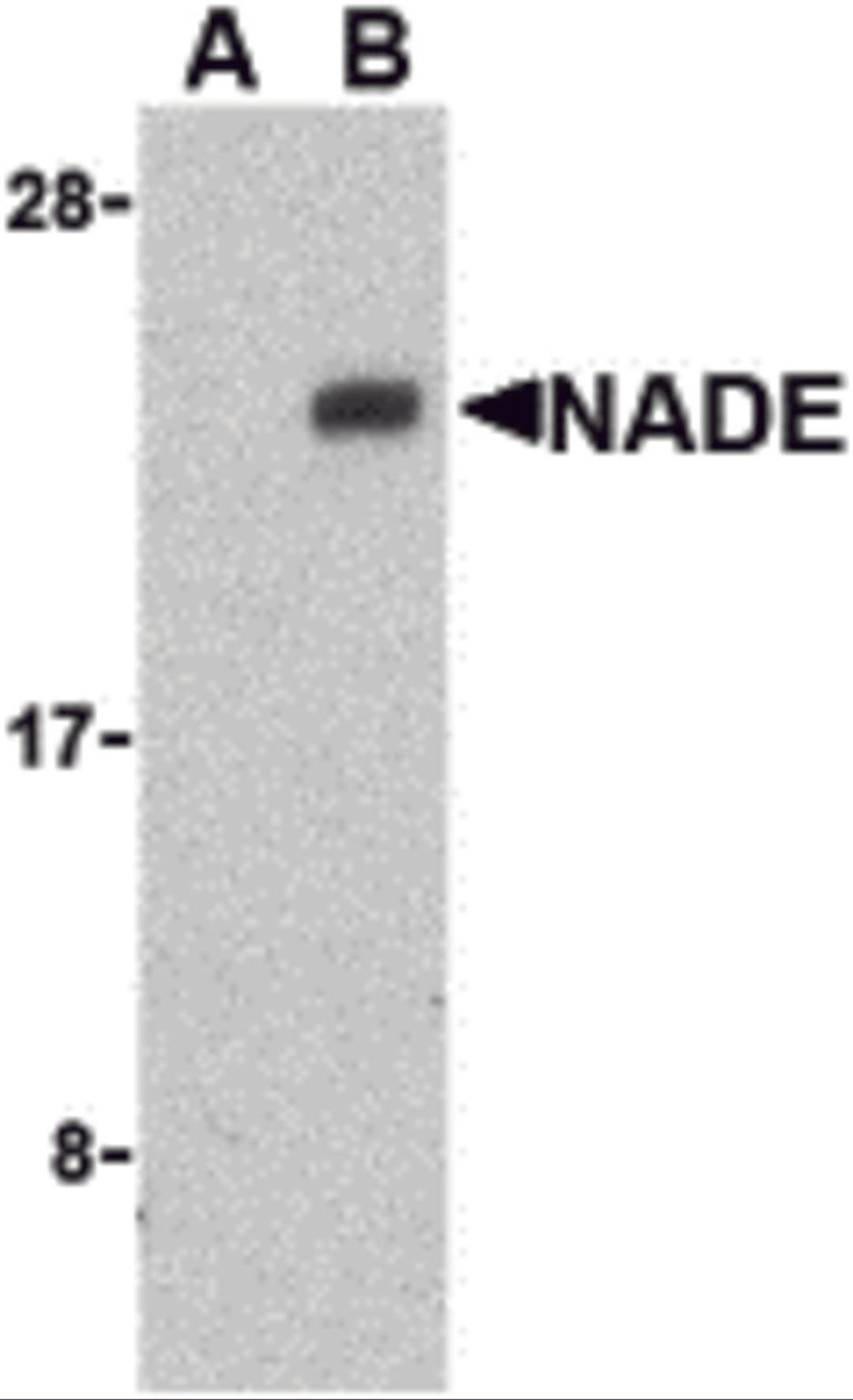 Western blot analysis of NADE in Human brain cell lysates with NADE antibody at 1 μg/mL in the presence (A) or absence (B) of blocking peptide.