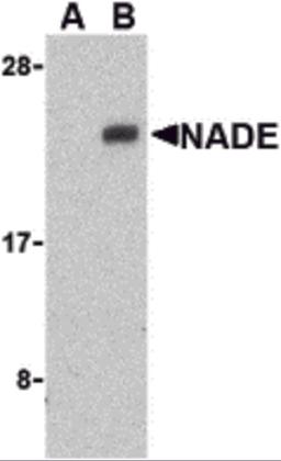 Western blot analysis of NADE in Human brain cell lysates with NADE antibody at 1 μg/mL in the presence (A) or absence (B) of blocking peptide.