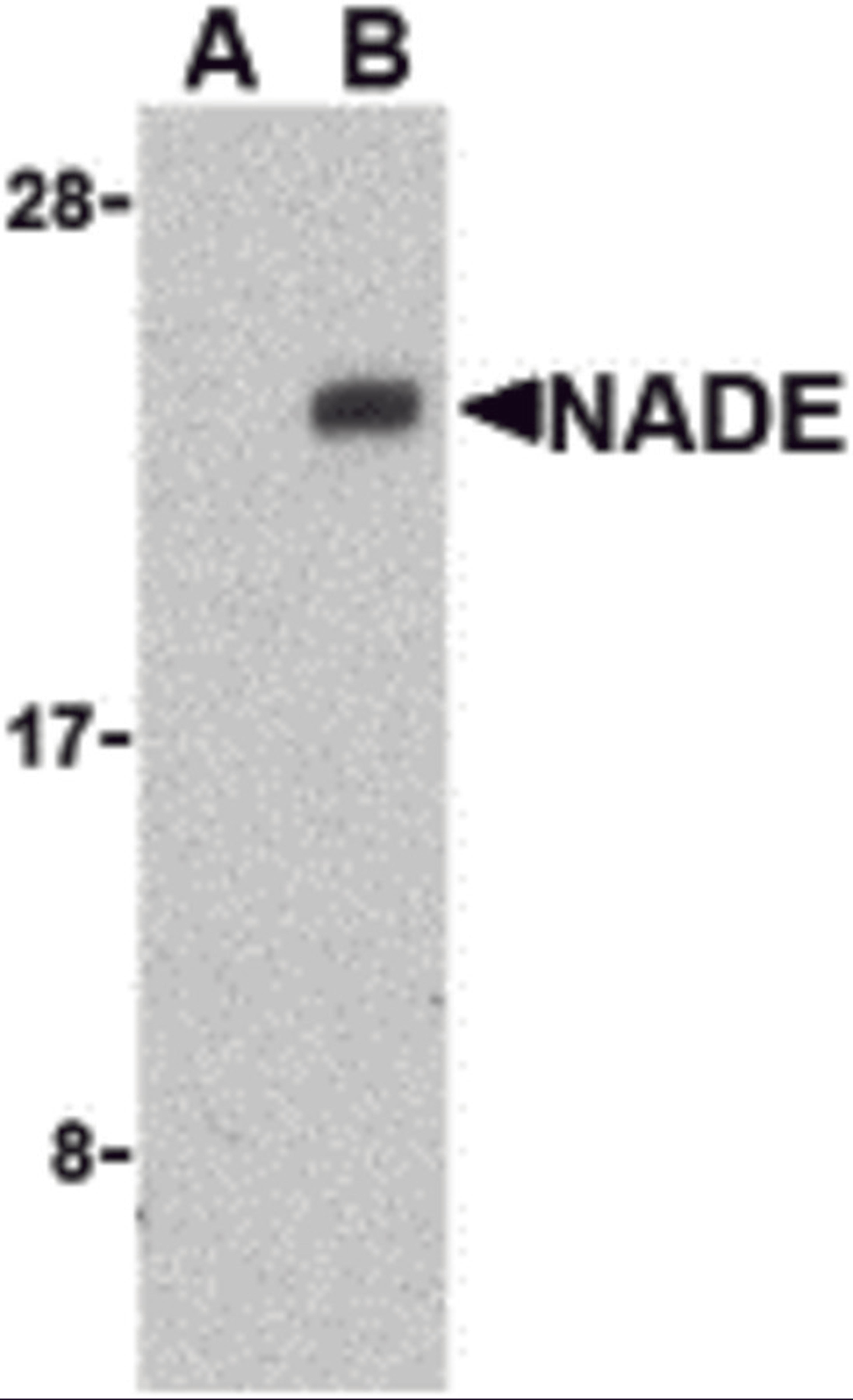 Western blot analysis of NADE in Human brain cell lysates with NADE antibody at 1 μg/mL in the presence (A) or absence (B) of blocking peptide.