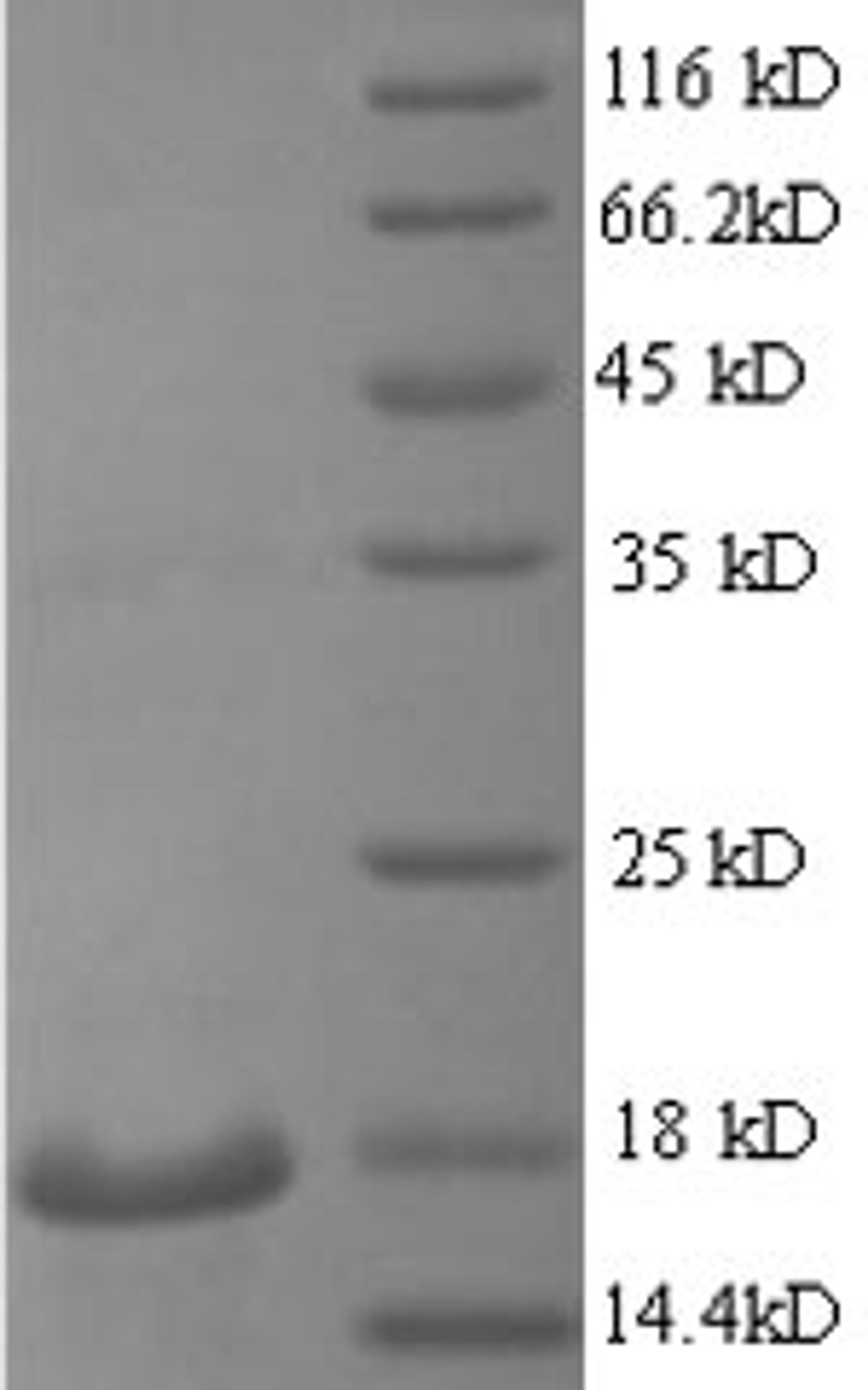 (Tris-Glycine gel) Discontinuous SDS-PAGE (reduced) with 5% enrichment gel and 15% separation gel.