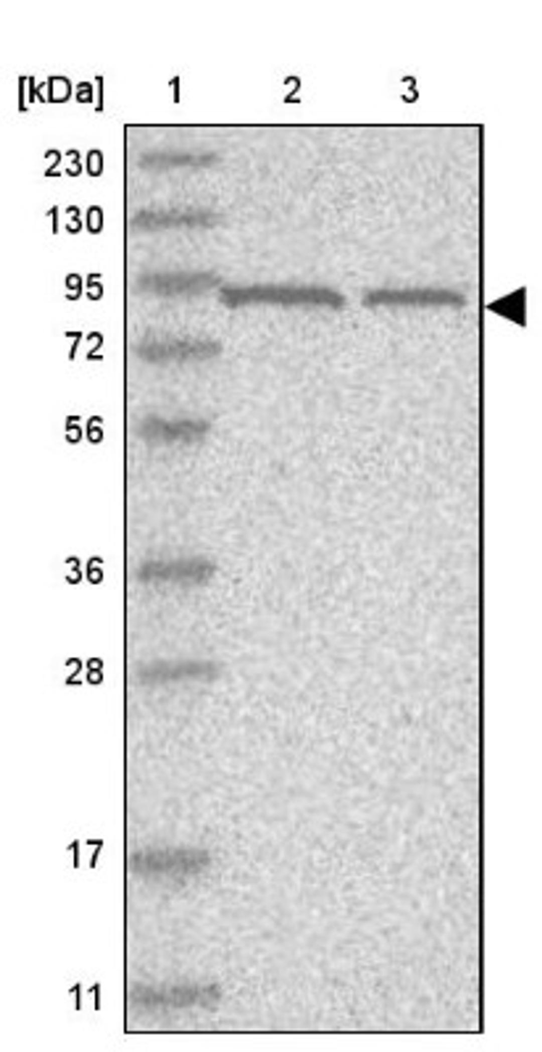 Western Blot: Virilizer Antibody [NBP1-85118] - Lane 1: Marker [kDa] 230, 130, 95, 72, 56, 36, 28, 17, 11<br/>Lane 2: Human cell line RT-4<br/>Lane 3: Human cell line U-251MG sp