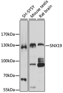 Western blot - SNX19 antibody (A5229)