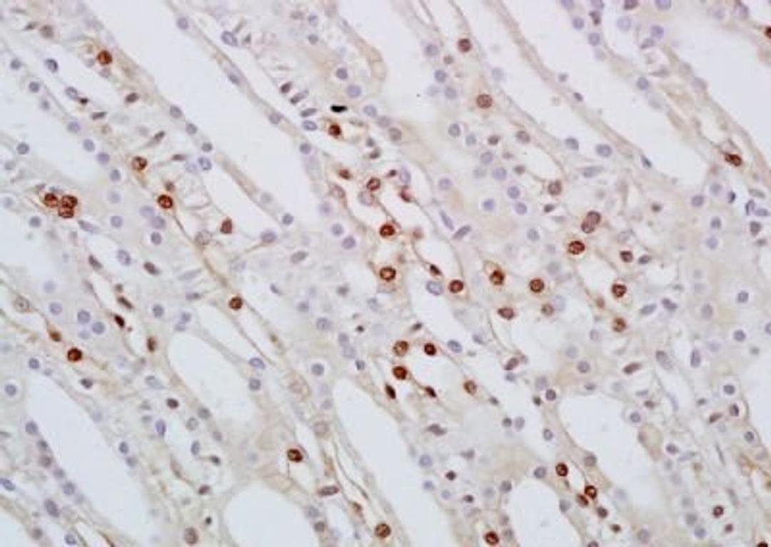 Immunohistochemical analysis of formalin-fixed paraffin embedded rat kidney tissue using SMARCA2 antibody (dilution at 1:200)