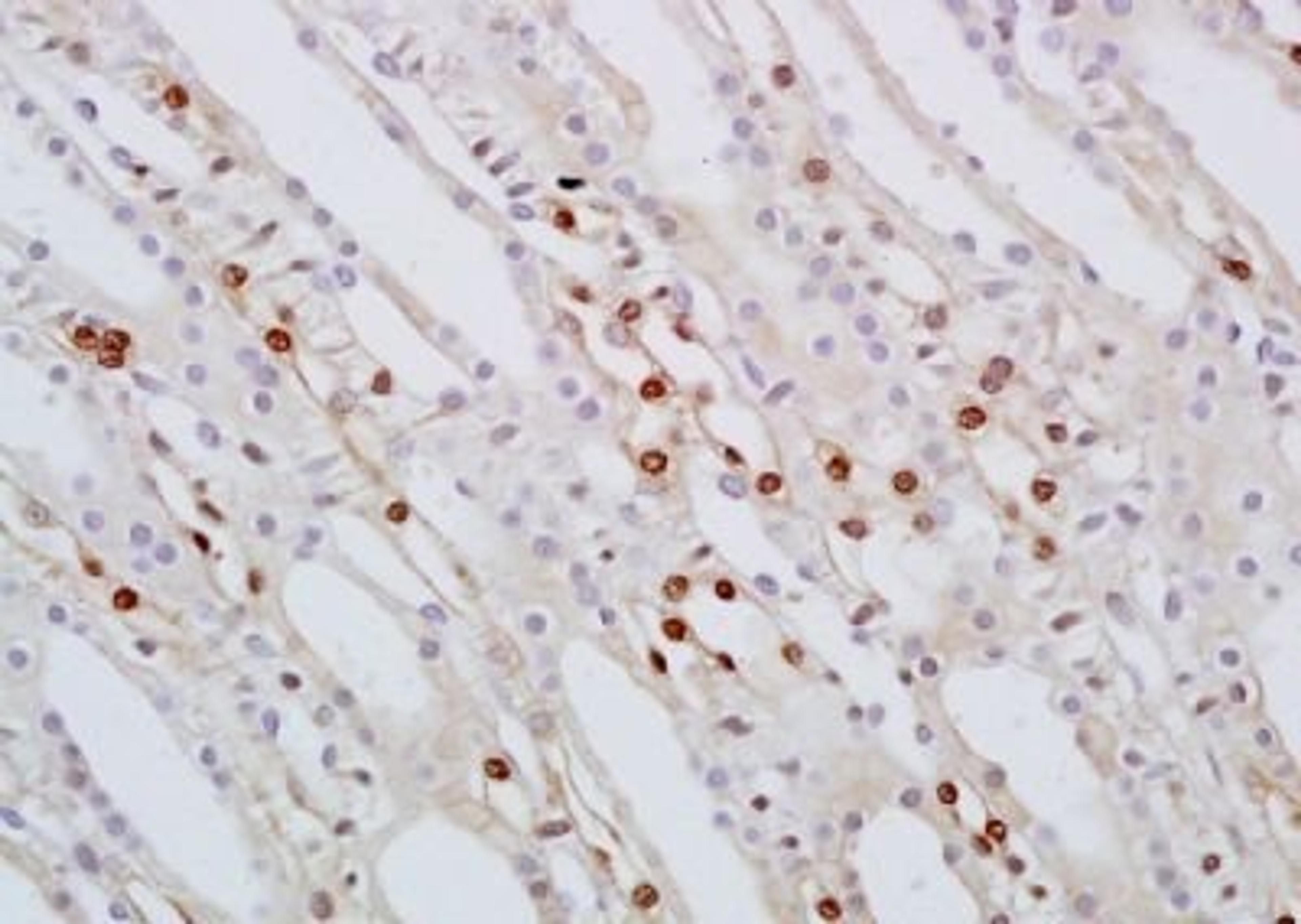 Immunohistochemical analysis of formalin-fixed paraffin embedded rat kidney tissue using SMARCA2 antibody (dilution at 1:200)