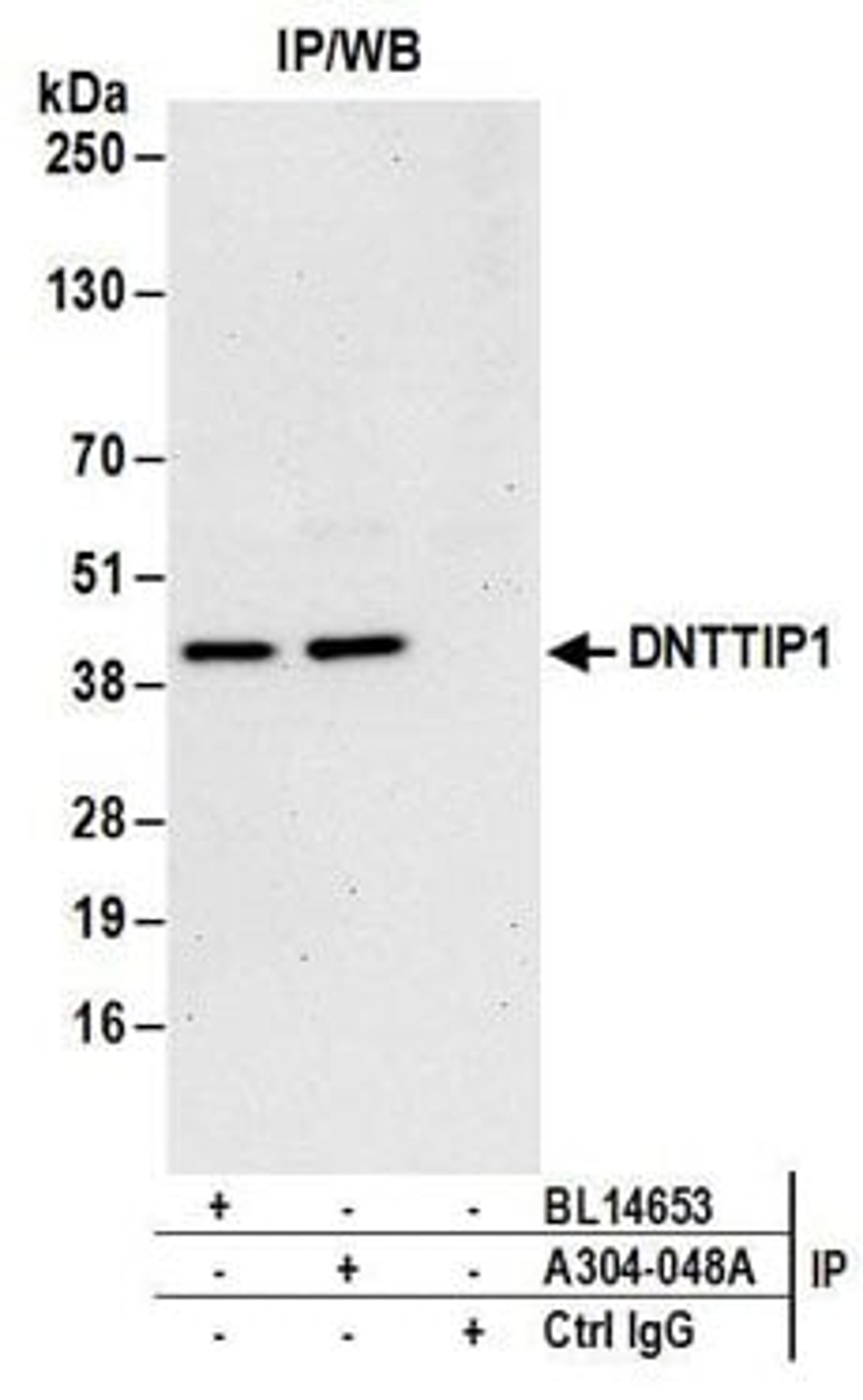 Detection of human DNTTIP1 by western blot of immunoprecipitates.