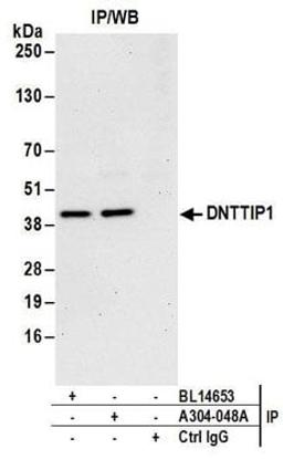 Detection of human DNTTIP1 by western blot of immunoprecipitates.