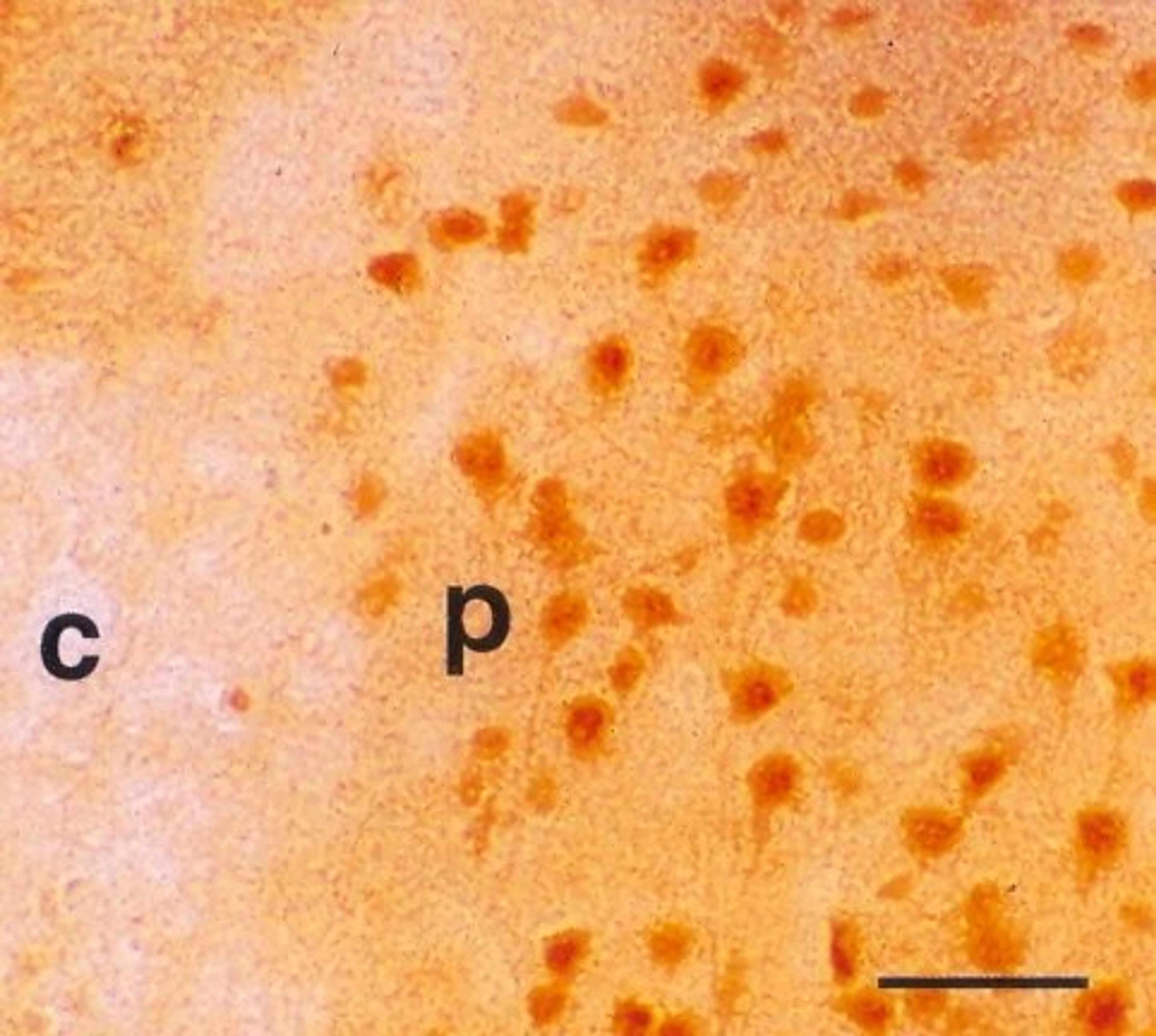 Immunohistochemical staining of rat Ischemic brain tissue using BVR antibody