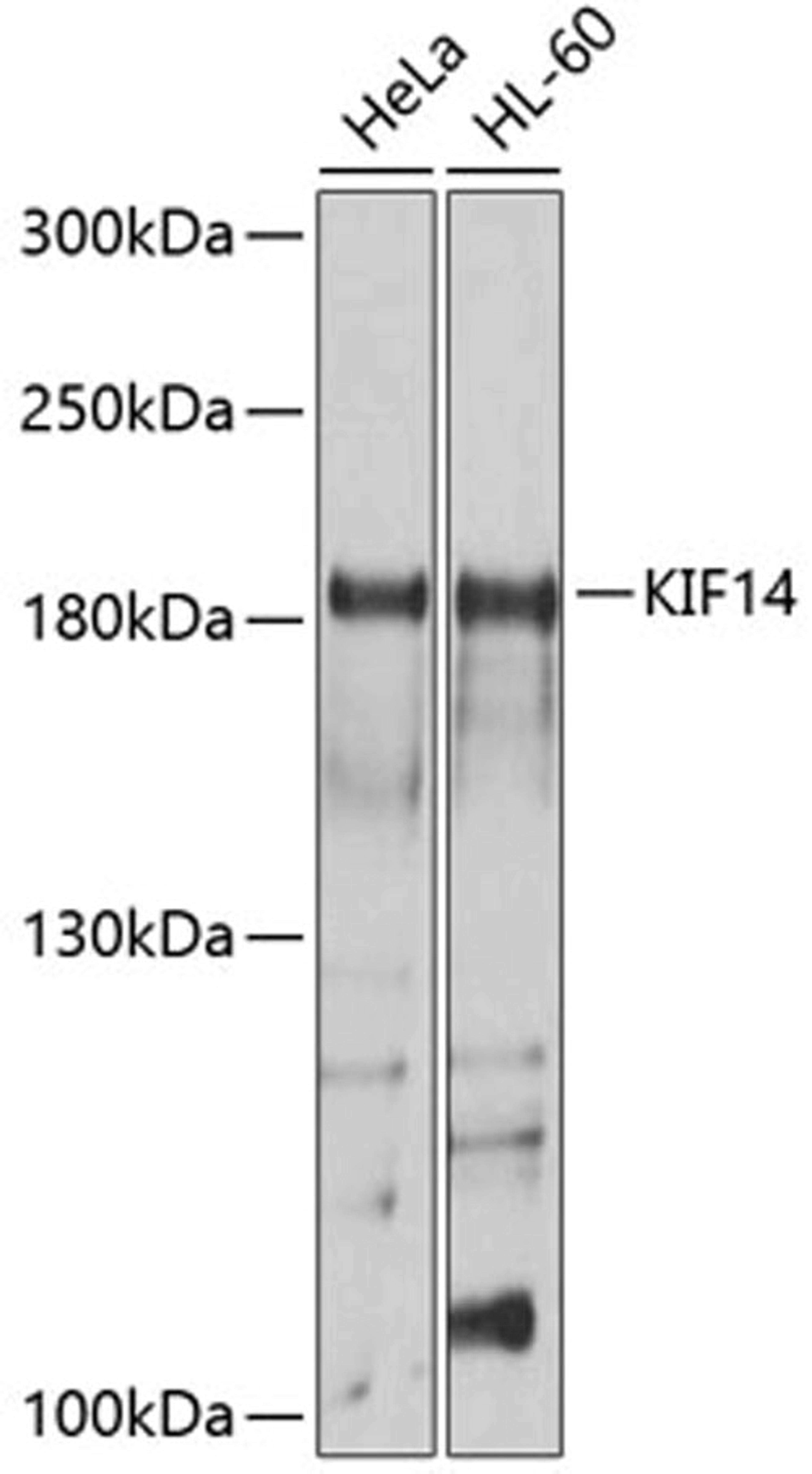 Western blot - KIF14 antibody (A10275)