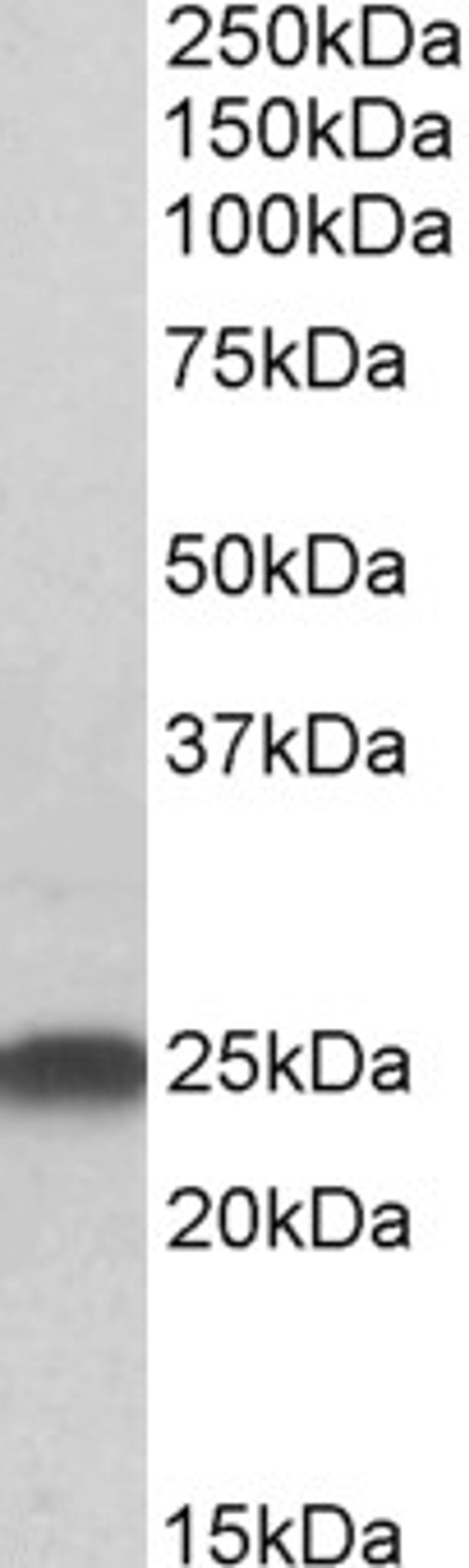 45-832 (0.5ug/ml) staining of Rat Brain lysate (35ug protein in RIPA buffer). Primary incubation was 1 hour. Detected by chemiluminescence.