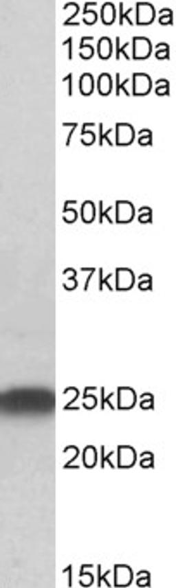 45-832 (0.5ug/ml) staining of Rat Brain lysate (35ug protein in RIPA buffer). Primary incubation was 1 hour. Detected by chemiluminescence.