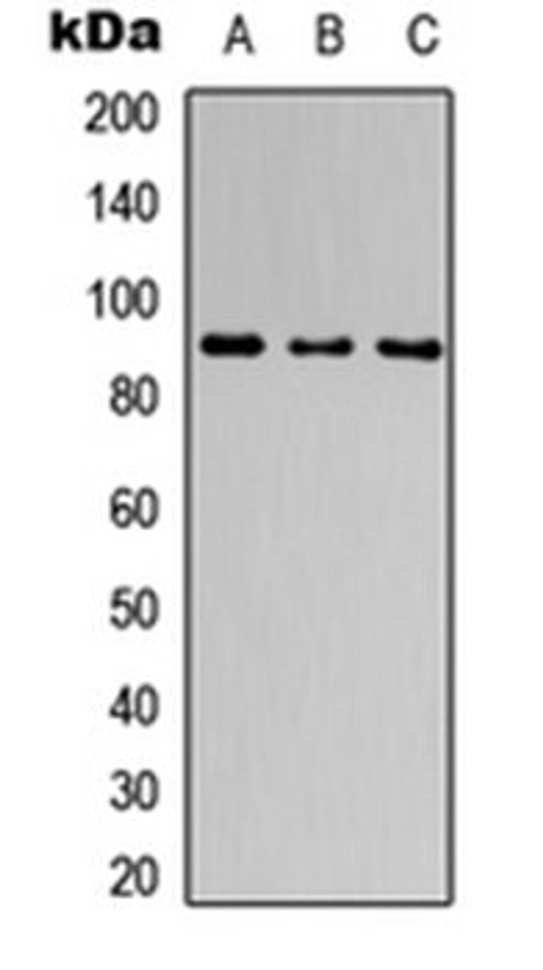 Western blot analysis of MCF7 (Lane 1), NS-1 (Lane 2), PC12 (Lane 3) whole cell lysates using CATSPER1 antibody