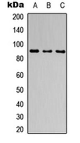 Western blot analysis of MCF7 (Lane 1), NS-1 (Lane 2), PC12 (Lane 3) whole cell lysates using CATSPER1 antibody