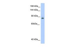 Antibody used in WB on Human kidney at 0.2-1 ug/ml.