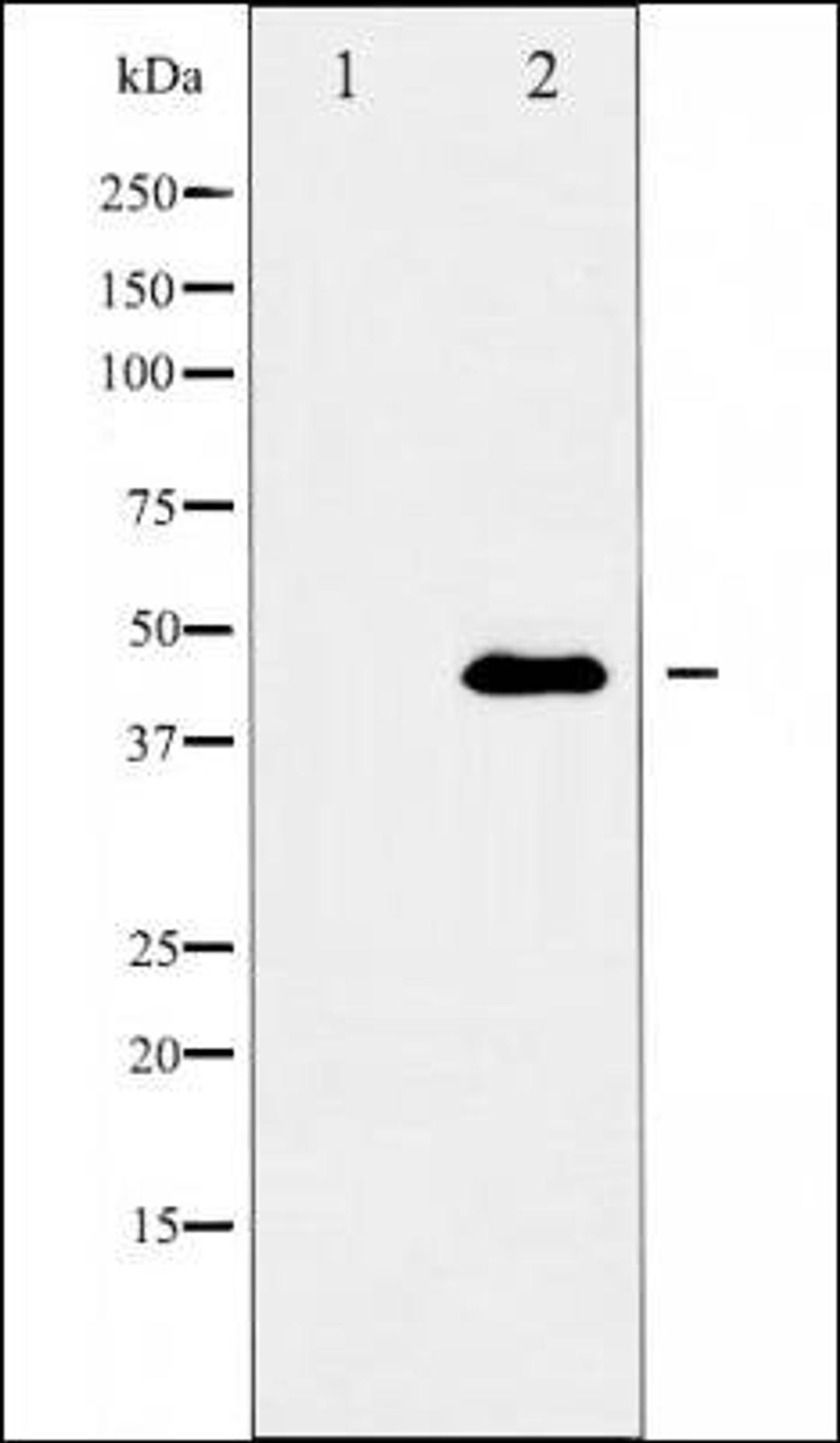 Western blot analysis of MCF-7 cells using PAI 2 antibody