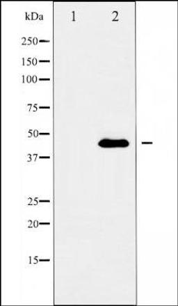 Western blot analysis of MCF-7 cells using PAI 2 antibody