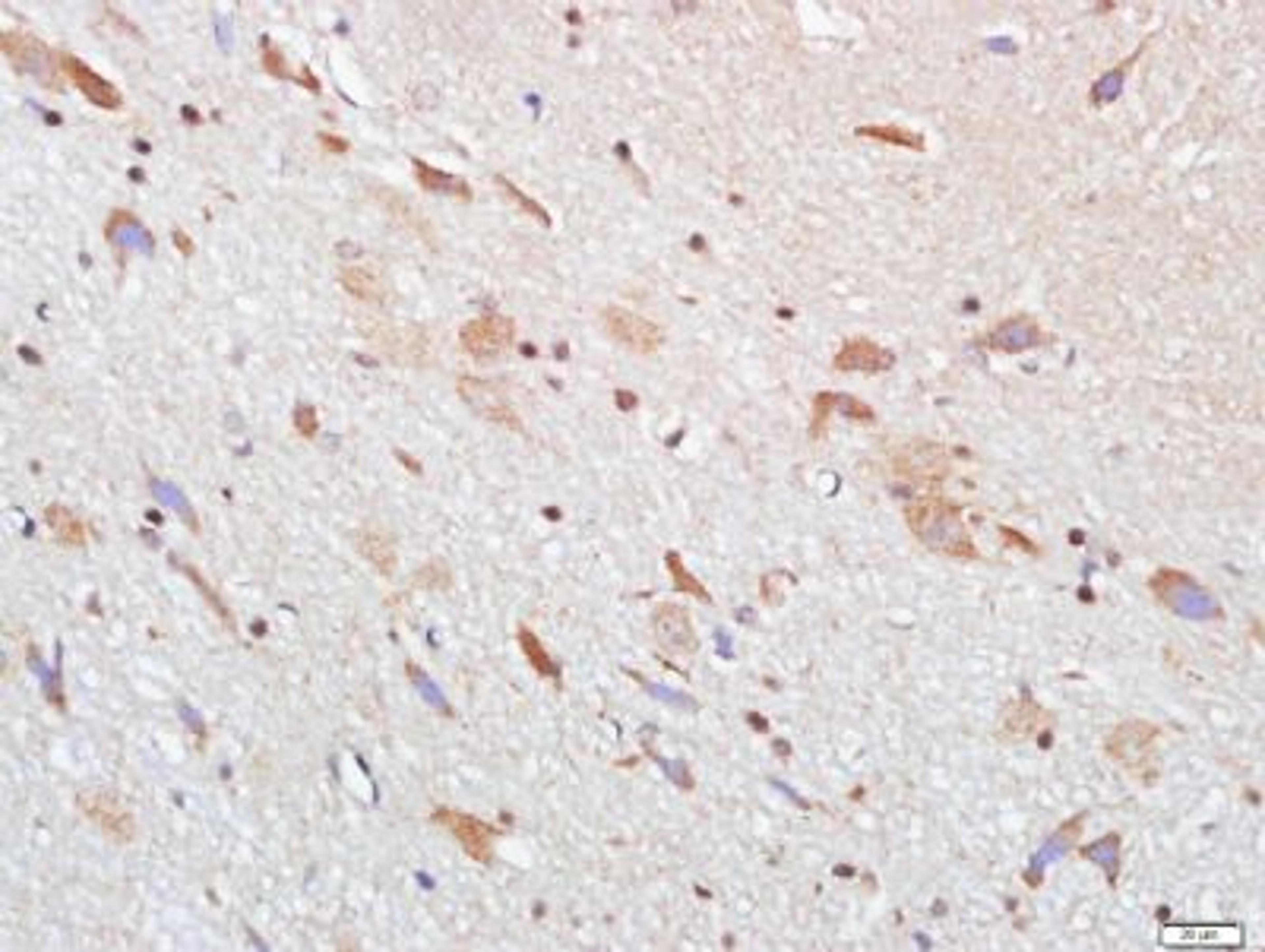 Immunohistochemical staining of Mouse brain tissue using CNG channel beta 1 antibody.