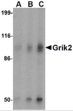 Western blot analysis of Grik2 in human brain tissue lysate with Grik2 antibody at (A) 0.5 and (B) 1 &#956;g/mL.