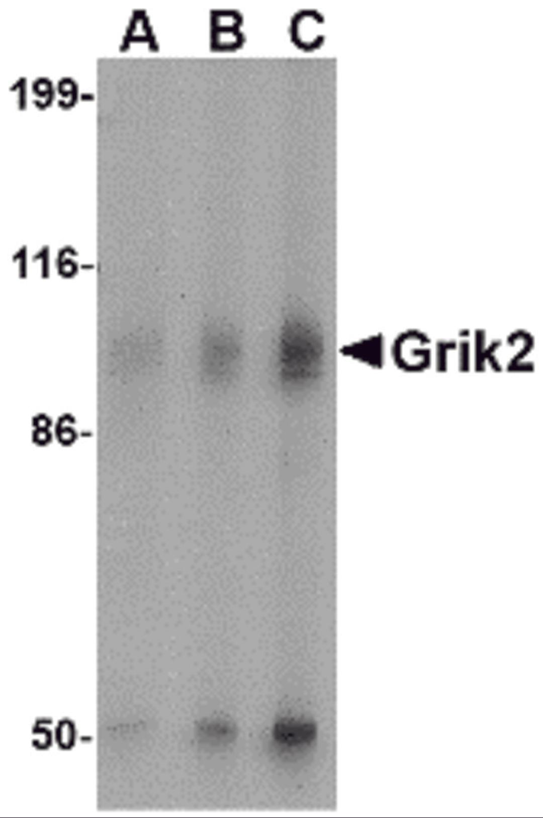 Western blot analysis of Grik2 in human brain tissue lysate with Grik2 antibody at (A) 0.5 and (B) 1 μg/mL.
