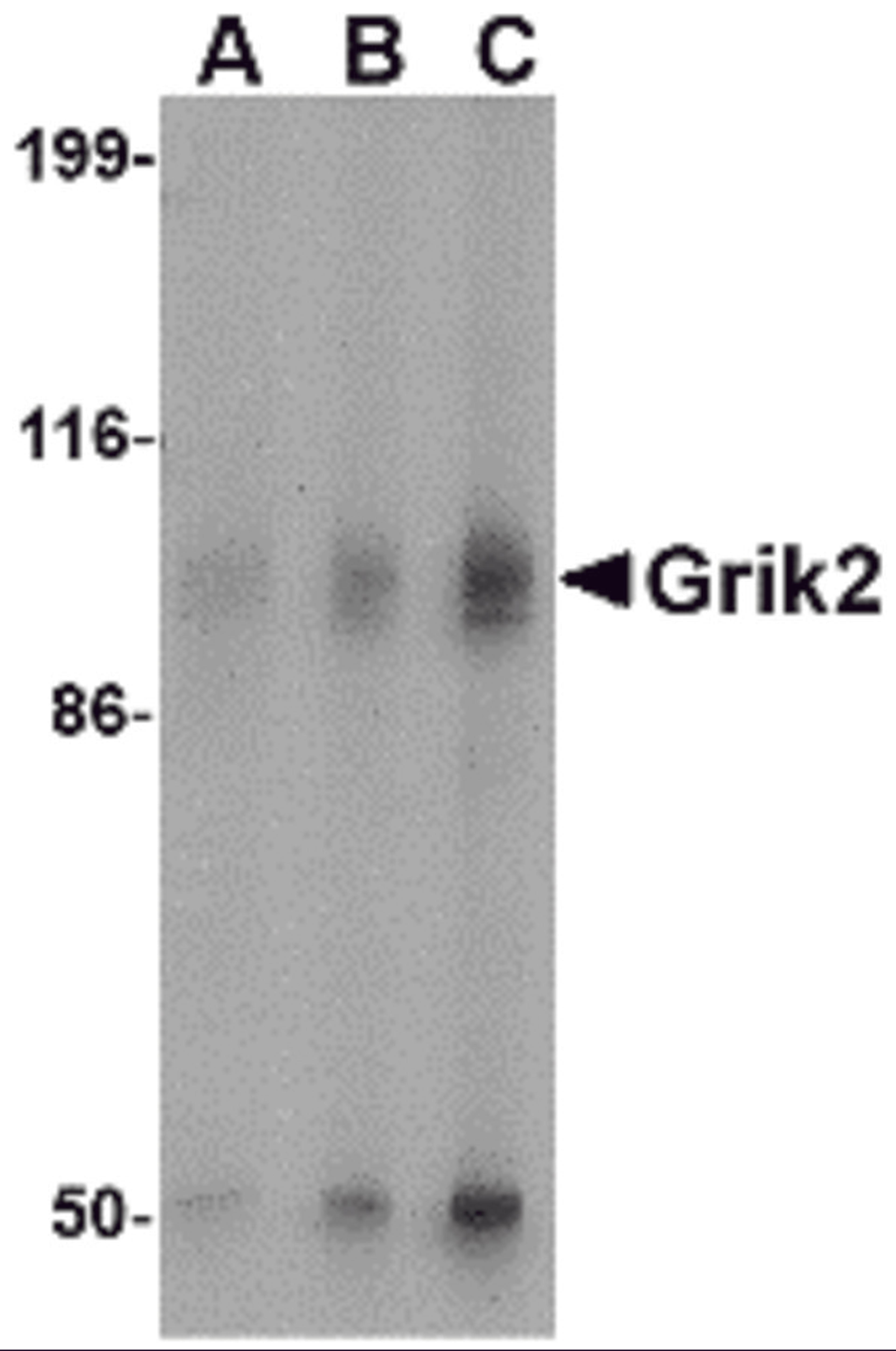 Western blot analysis of Grik2 in human brain tissue lysate with Grik2 antibody at (A) 0.5 and (B) 1 μg/mL.