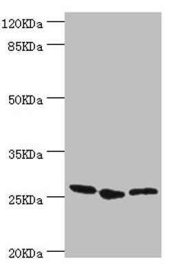 Western blot. All lanes: YEATS4 antibody at 1.44µg/ml. Lane 1: A549 whole cell lysate. Lane 2: Rat gonad tissue. Lane 3: U251 whole cell lysate. Secondary. Goat polyclonal to rabbit IgG at 1/10000 dilution. Predicted band size: 26 kDa. Observed band size: 26 kDa