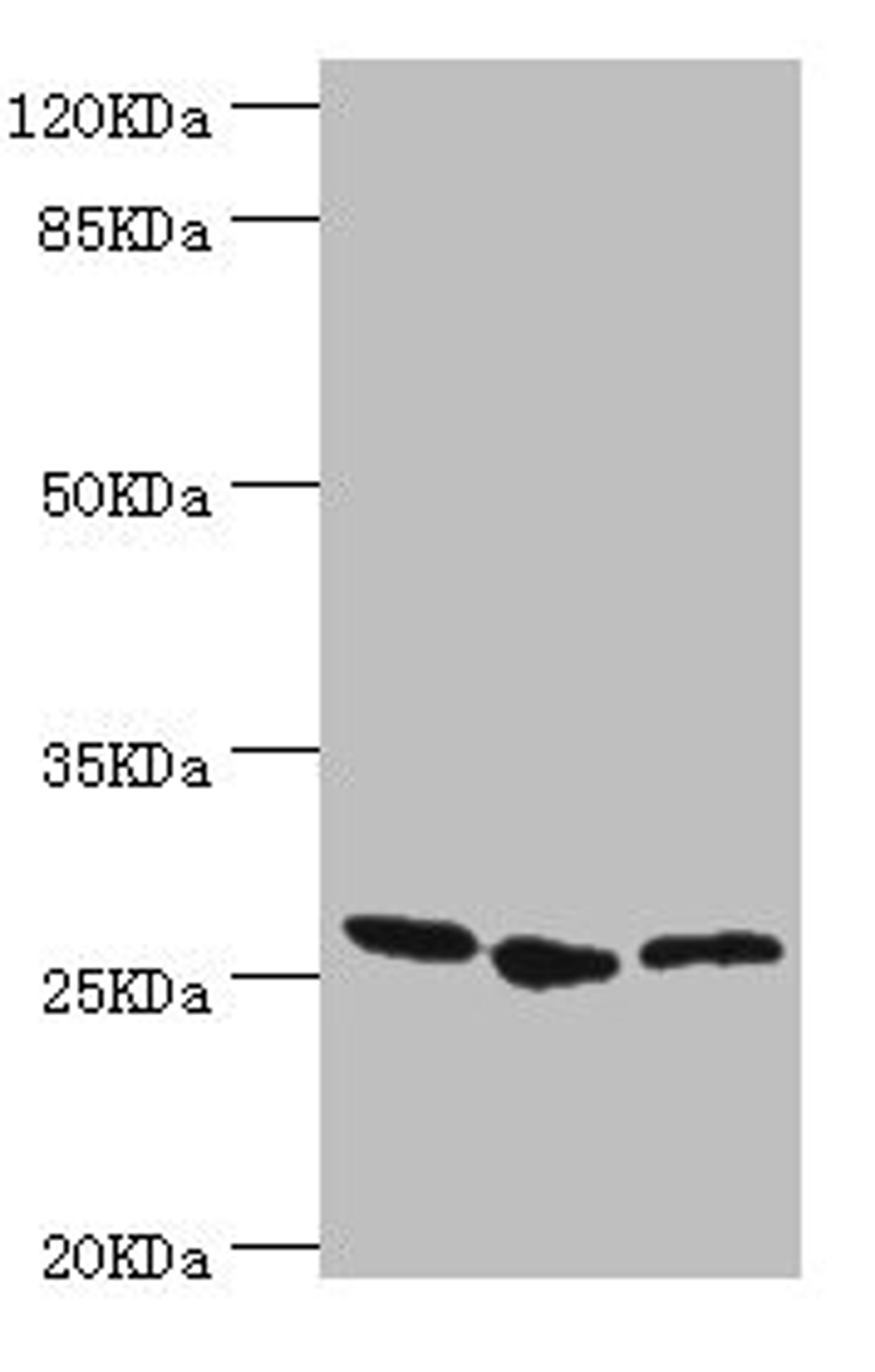 Western blot. All lanes: YEATS4 antibody at 1.44µg/ml. Lane 1: A549 whole cell lysate. Lane 2: Rat gonad tissue. Lane 3: U251 whole cell lysate. Secondary. Goat polyclonal to rabbit IgG at 1/10000 dilution. Predicted band size: 26 kDa. Observed band size: 26 kDa