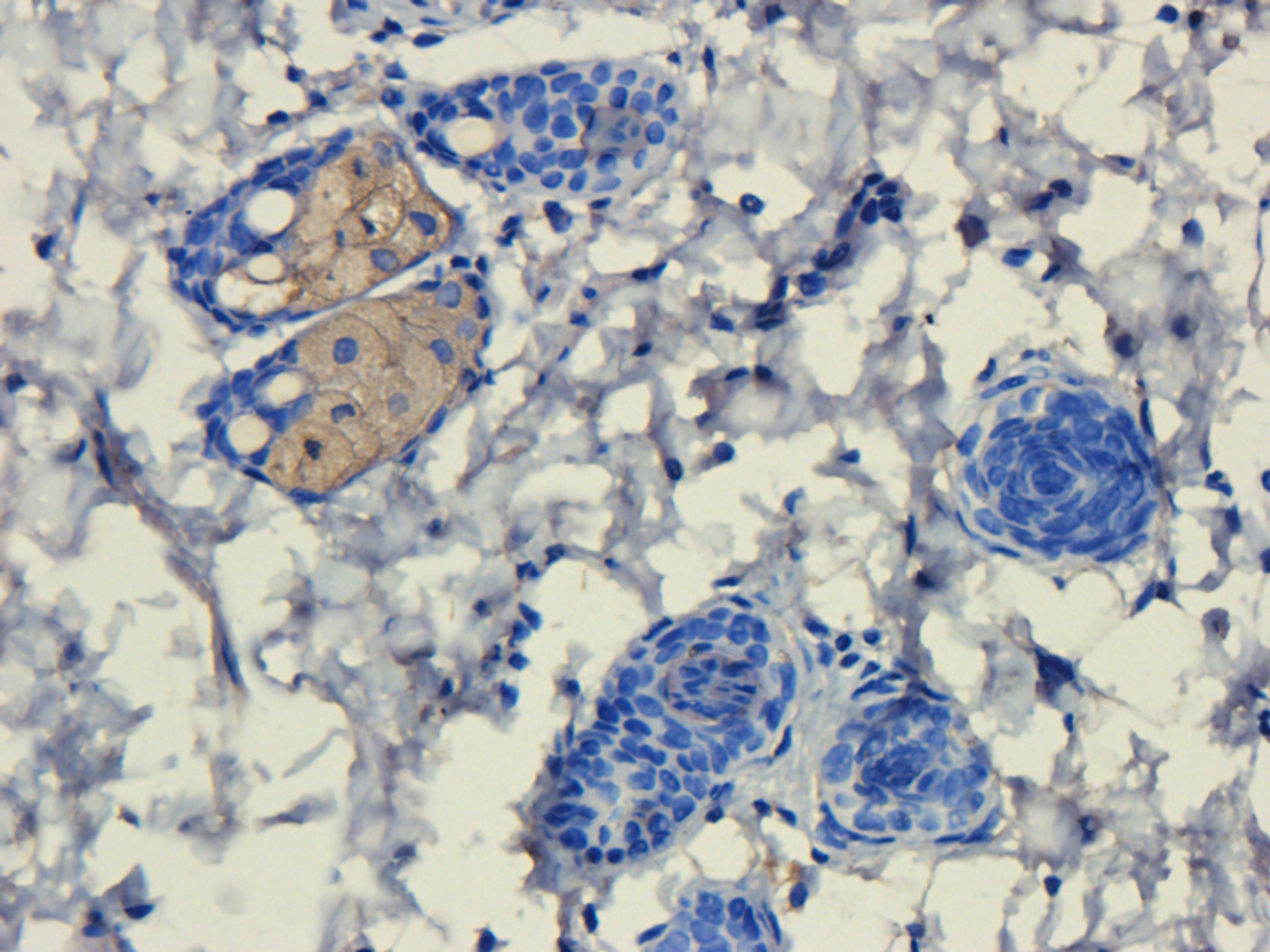 IHC-P staining of rat skin tissue using anti-FOXP3 (dilution at 1:200)