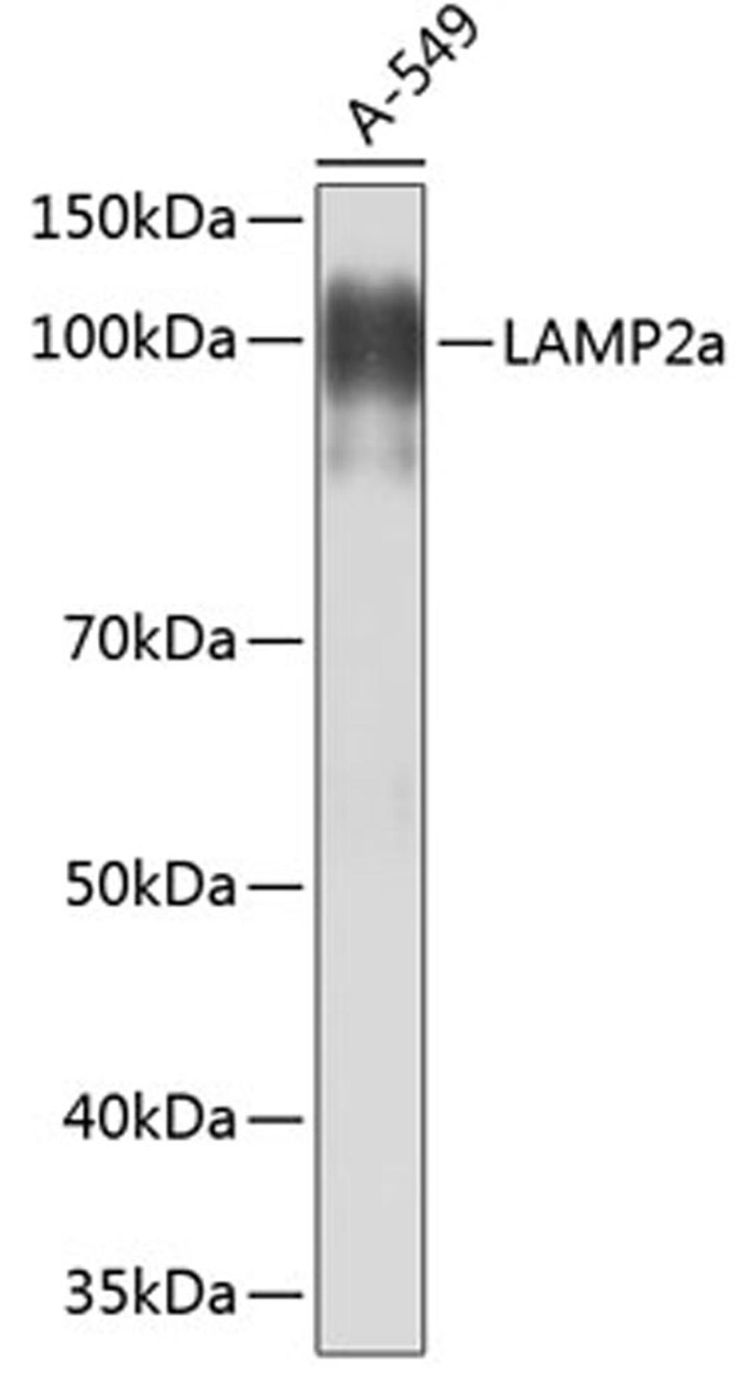 Western blot - LAMP2a Rabbit mAb (A0593)