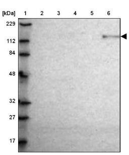 Western Blot: Integrin alpha 5 Antibody [NBP1-84576] - Lane 1: Marker [kDa] 229, 112, 84, 48, 32, 27, 17<br/>Lane 2: Human cell line RT-4<br/>Lane 3: Human cell line U-251MG sp<br/>Lane 4: Human plasma (IgG/HSA depleted)<br/>Lane 5: Human liver tissue<br/>Lane 6: Human tonsil tissue