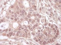 Detection of human THOC1 by immunohistochemistry.