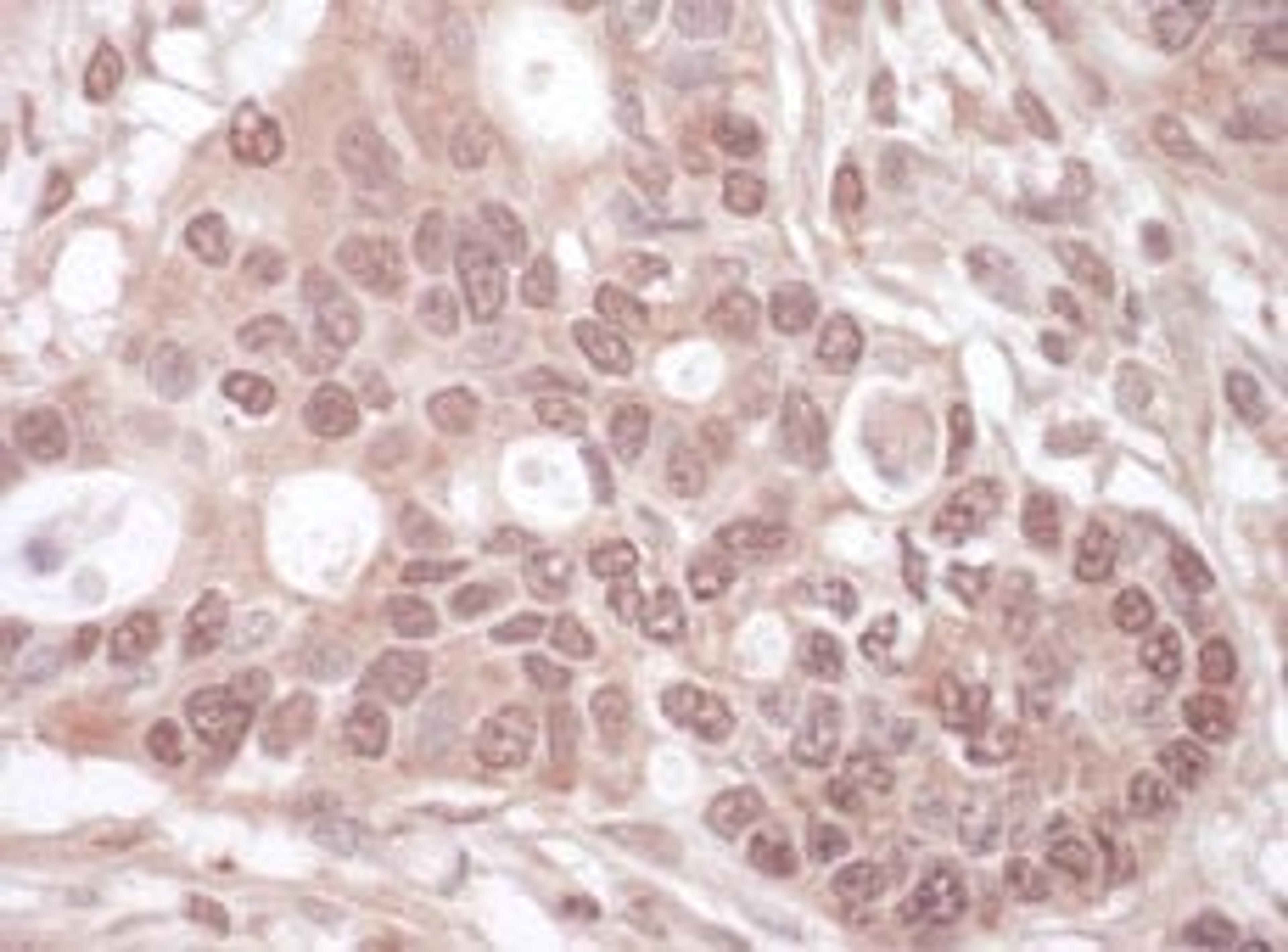 Detection of human THOC1 by immunohistochemistry.