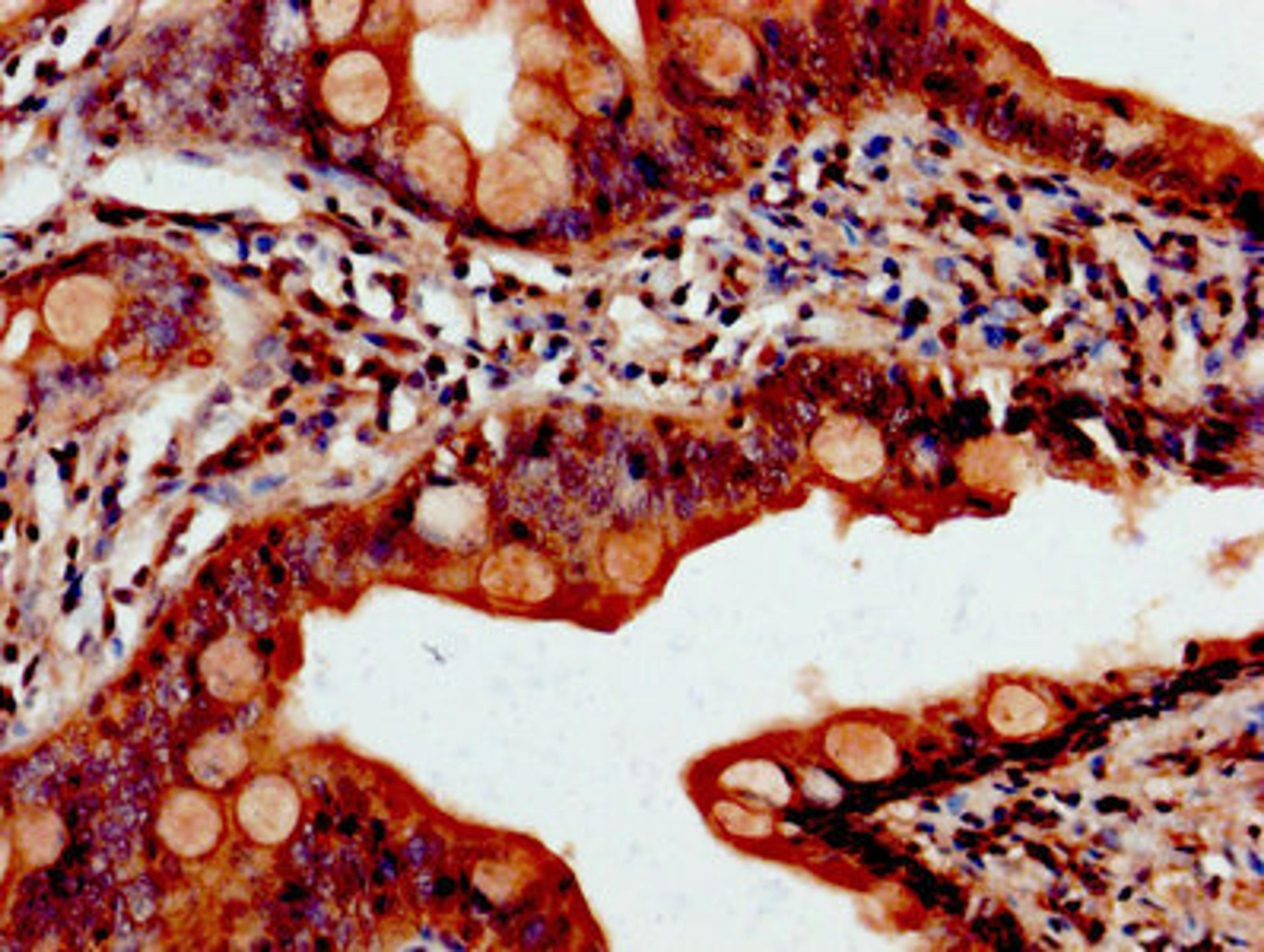 IHC image of CSB-PA861141HA01HU diluted at 1:800 and staining in paraffin-embedded human small intestine tissue performed on a Leica BondTM system. After dewaxing and hydration, antigen retrieval was mediated by high pressure in a citrate buffer (pH 6.0). Section was blocked with 10% normal goat serum 30min at RT. Then primary antibody (1% BSA) was incubated at 4&deg;C overnight. The primary is detected by a biotinylated secondary antibody and visualized using an HRP conjugated SP system.