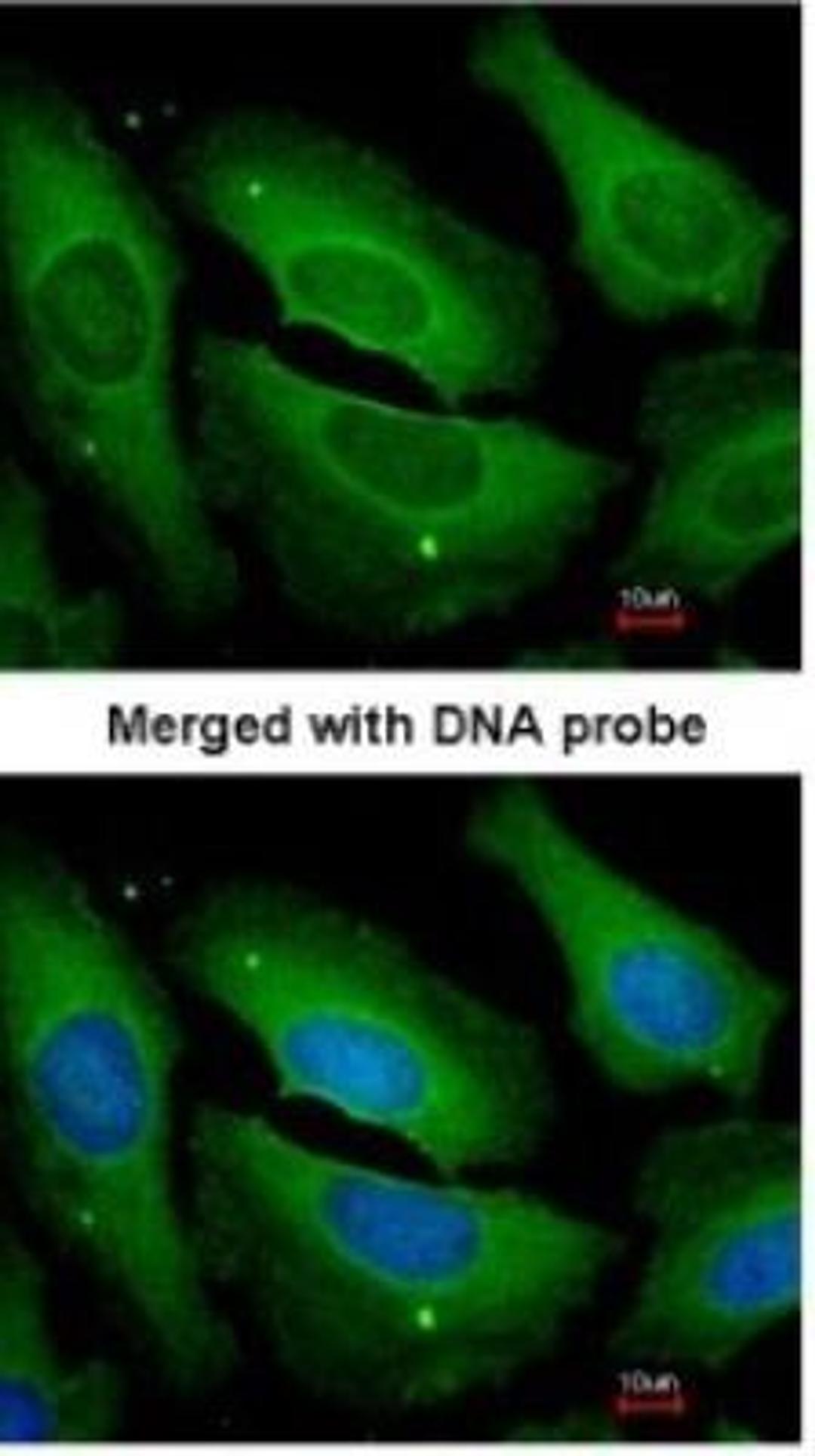 Immunocytochemistry/Immunofluorescence: Protein Phosphatase 1C gamma Antibody [NBP1-32858] - Paraformaldehyde-fixed HeLa, using antibody at 1:200 dilution.