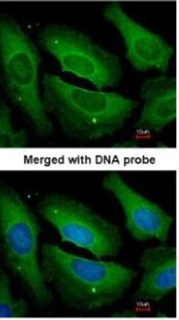 Immunocytochemistry/Immunofluorescence: Protein Phosphatase 1C gamma Antibody [NBP1-32858] - Paraformaldehyde-fixed HeLa, using antibody at 1:200 dilution.