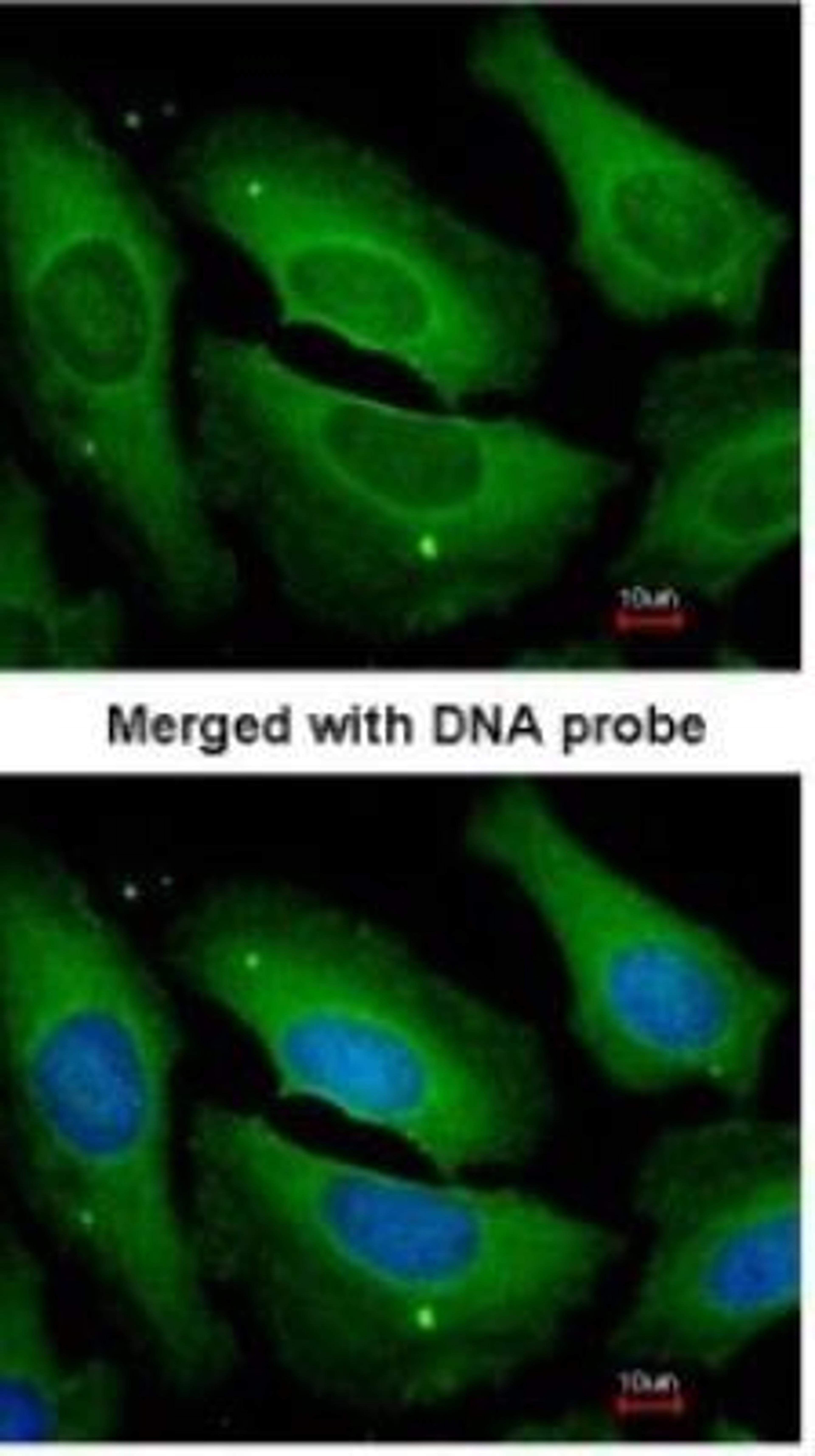 Immunocytochemistry/Immunofluorescence: Protein Phosphatase 1C gamma Antibody [NBP1-32858] - Paraformaldehyde-fixed HeLa, using antibody at 1:200 dilution.