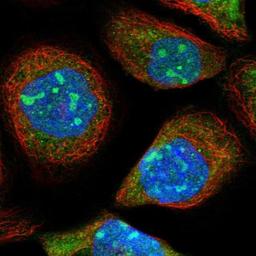 Immunocytochemistry/Immunofluorescence: ZFAND2B Antibody [NBP1-89174] - Staining of human cell line A-431 shows positivity in nucleus, nucleoli & cytoplasm.