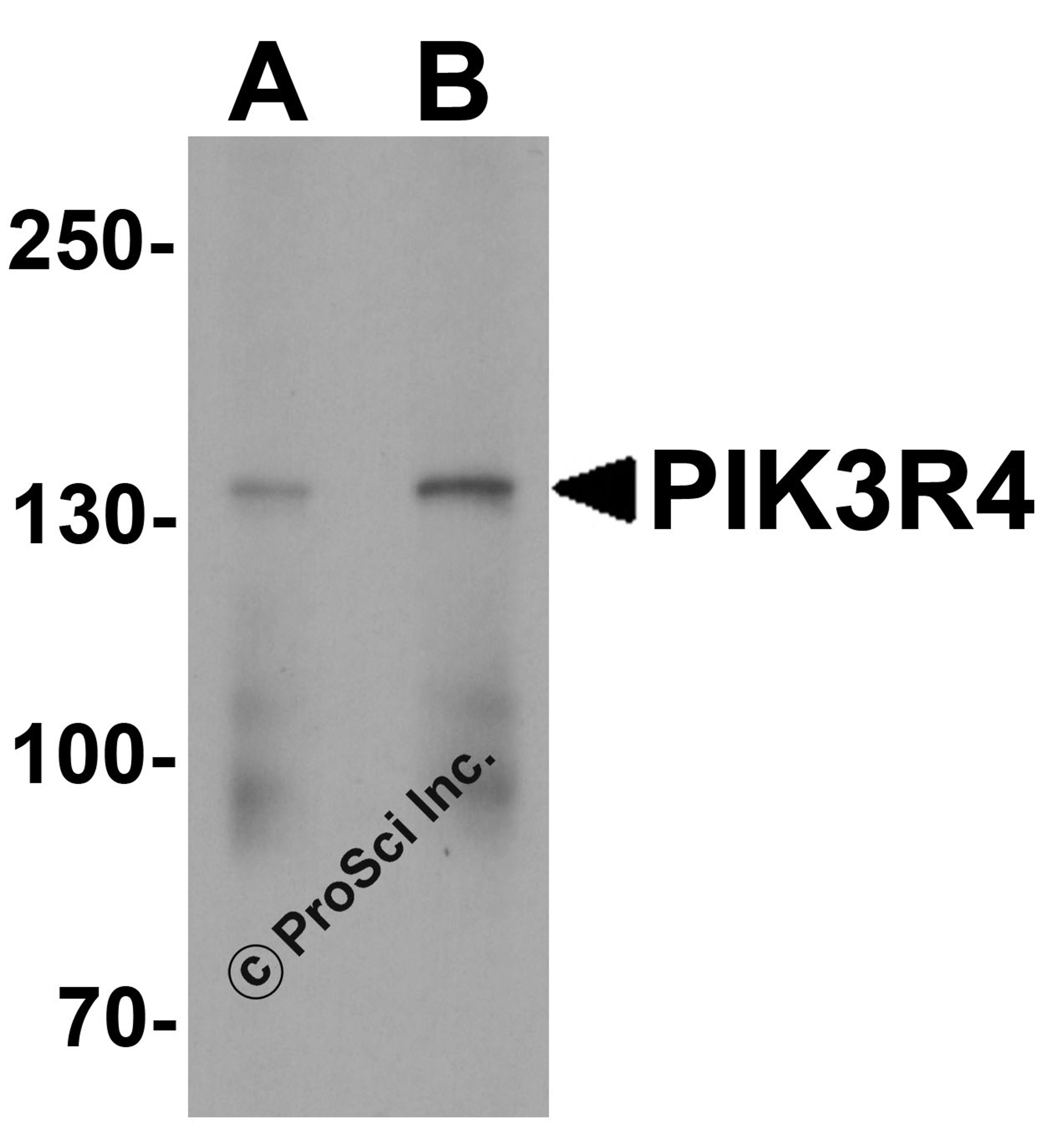 Western blot analysis of PIK3R4 in human tonsil tissue lysate with PIK3R4 antibody at (A) 1 and (B) 2 &#956;g/ml.