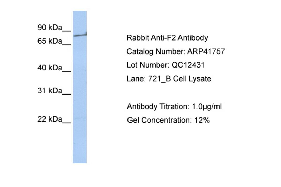 Antibody used in WB on Human 721_B at 1 ug/ml.