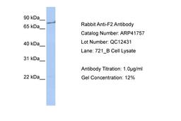 Antibody used in WB on Human 721_B at 1 ug/ml.