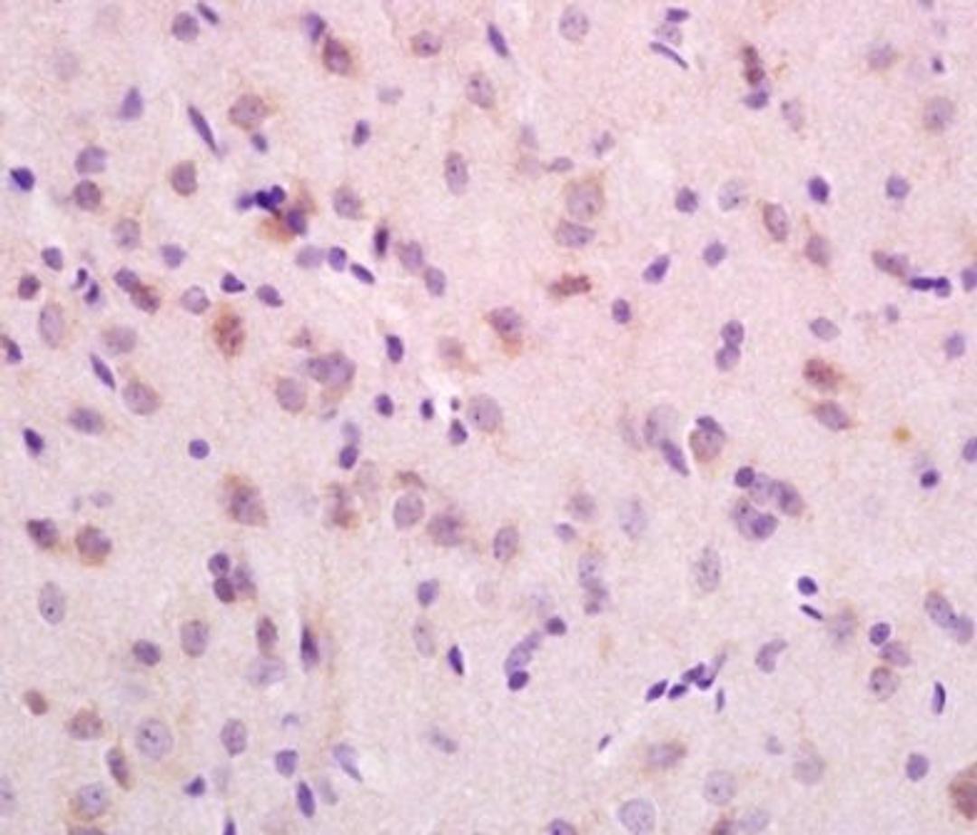 Paraffin-embedded rat brain tissue fixed with 4% paraformaldehyde. Antigen retrieval by boiling with citrate buffer. Blocking buffer is goat serum (37 degrees for 20 min.). ZNF804A antibody at 1:200 dilution with overnight incubation at 4 degrees