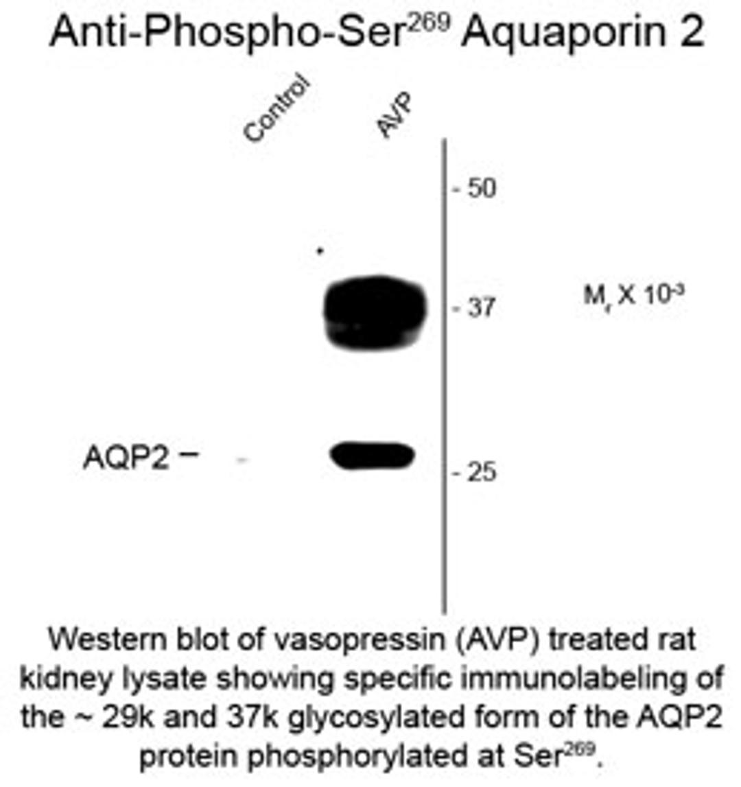 Western blot of vasopressin (AVP) treated rat kidney lysate showing specific immunolabeling of the ~29k and 37k glycosylated form of the AQP2 protein phosphorlyated at Ser269.