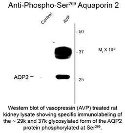 Western blot of vasopressin (AVP) treated rat kidney lysate showing specific immunolabeling of the ~29k and 37k glycosylated form of the AQP2 protein phosphorlyated at Ser269.