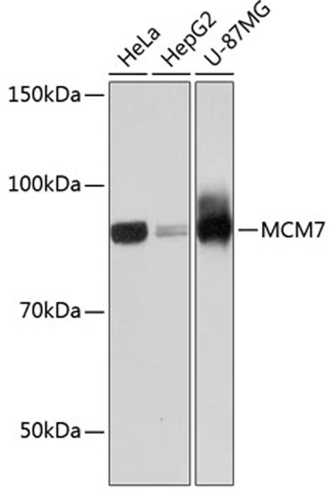 Western blot - MCM7 Rabbit mAb (A11325)