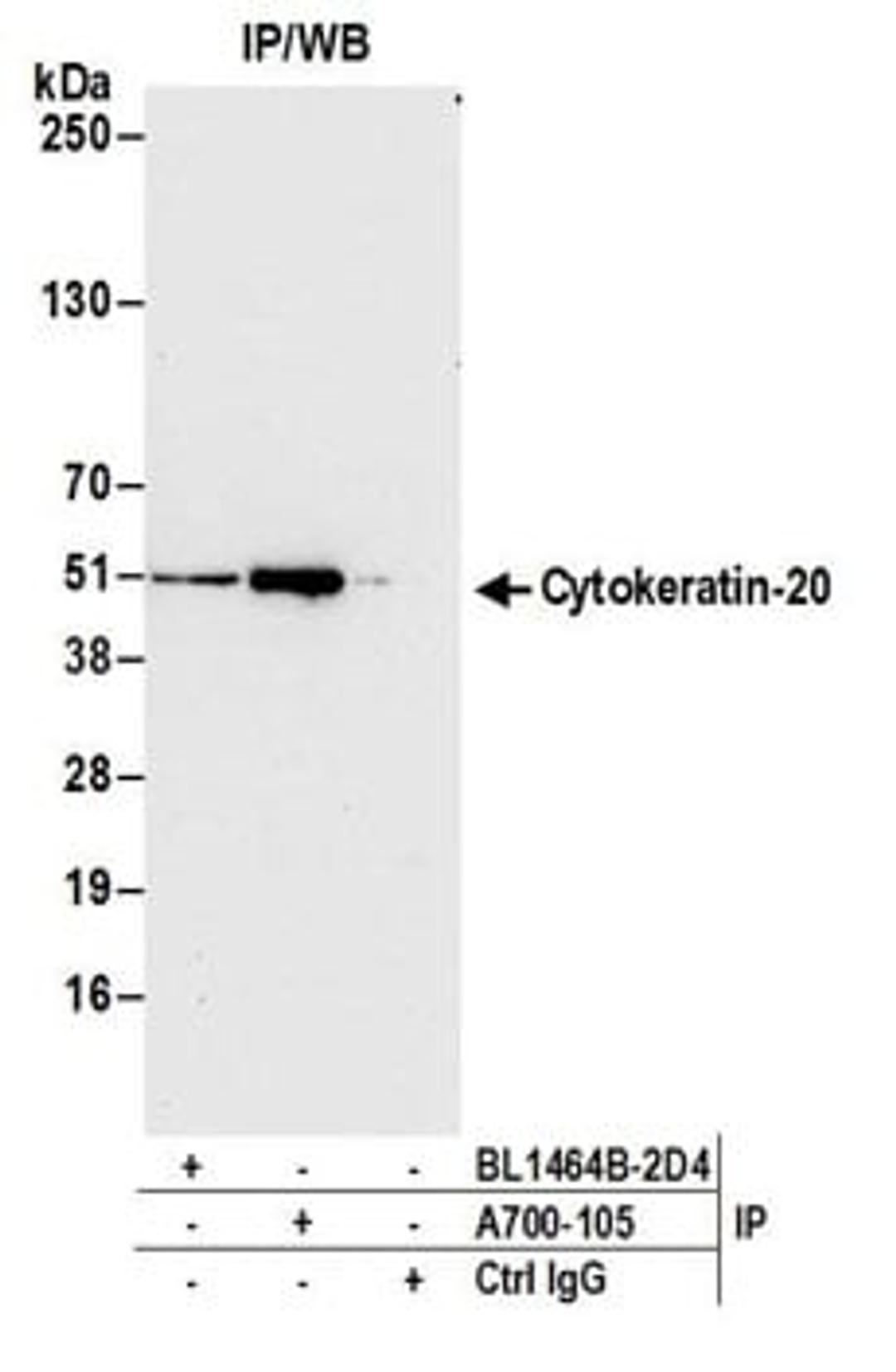 Detection of human Cytokeratin-20 by western blot of immunoprecipitates.