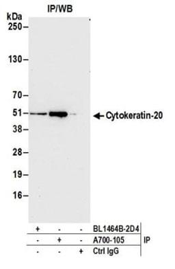 Detection of human Cytokeratin-20 by western blot of immunoprecipitates.