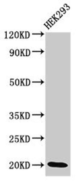 Western Blot. Positive WB detected in: HEK293 whole cell lysate. All lanes: DLX6 antibody at 3.4ug/ml. Secondary. Goat polyclonal to rabbit IgG at 1/50000 dilution. Predicted band size: 20, 30, 33 kDa. Observed band size: 20 kDa.