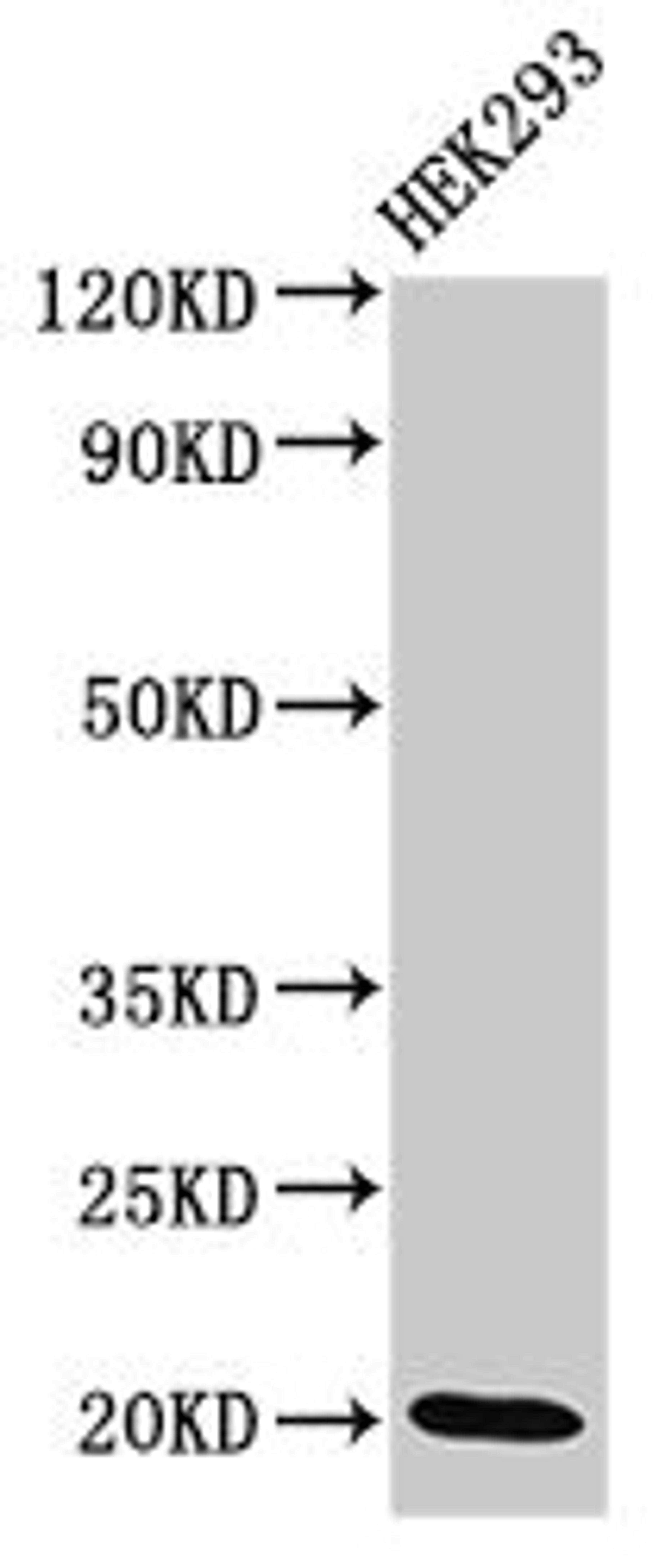 Western Blot. Positive WB detected in: HEK293 whole cell lysate. All lanes: DLX6 antibody at 3.4ug/ml. Secondary. Goat polyclonal to rabbit IgG at 1/50000 dilution. Predicted band size: 20, 30, 33 kDa. Observed band size: 20 kDa.